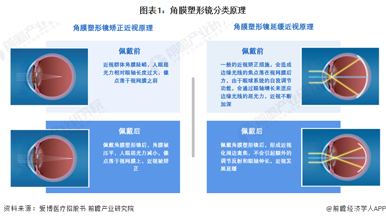 预见2024：2024年中国角膜塑形镜行业市场规模、竞争格局及发展前景预测未来市场规模有望突破100亿元(图1)